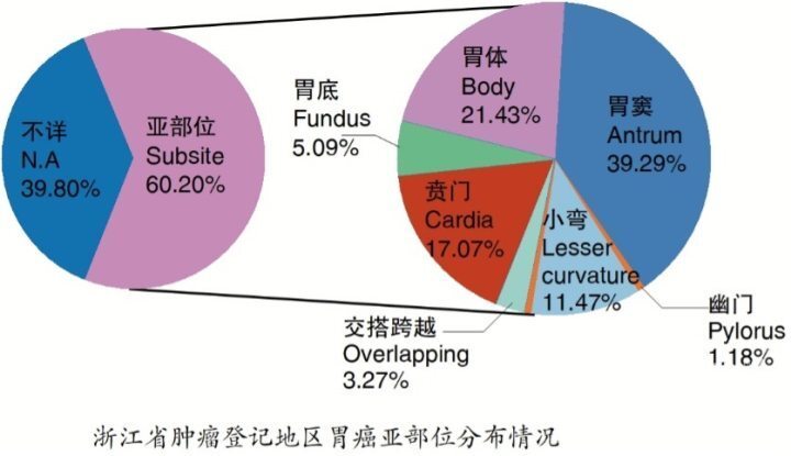 年轻人患胃癌概率升高的现状、原因及预防措施