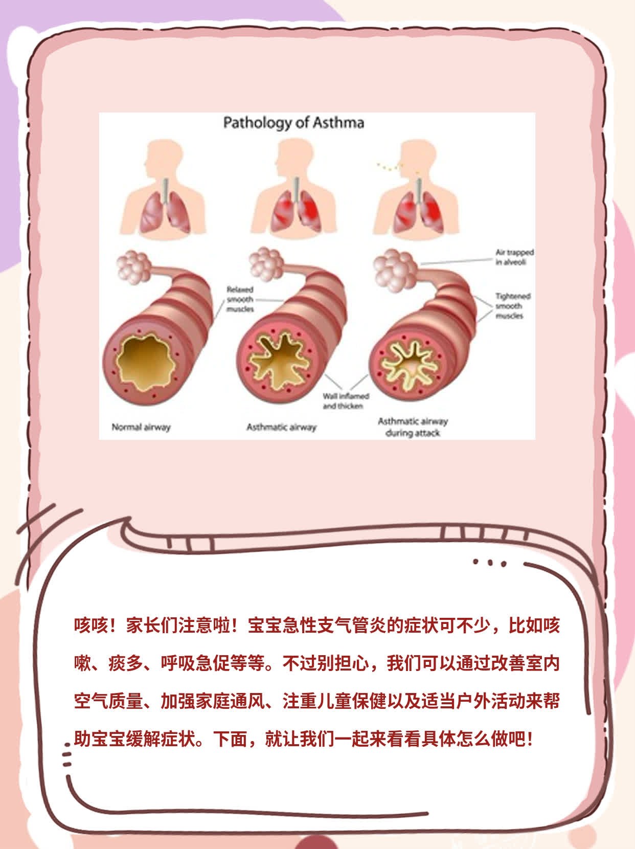 小儿支气管炎四阶段与应对之策详解